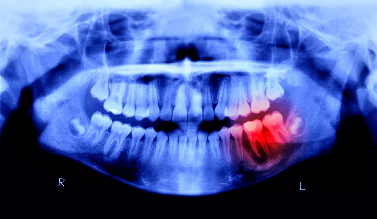 You don't want your gums to become infected and your teeth to fall out, do you? (Getty Stock Photo)