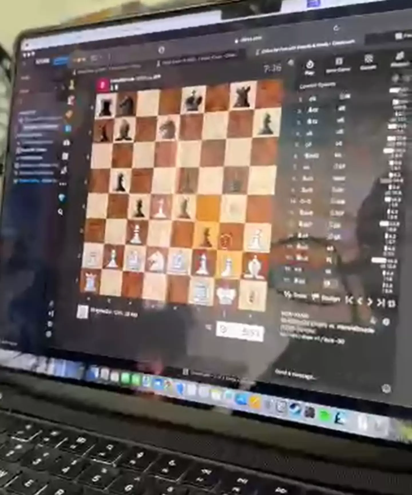 Noland has been been able to play chess with a chip in his brain. (X/@Neuralink)