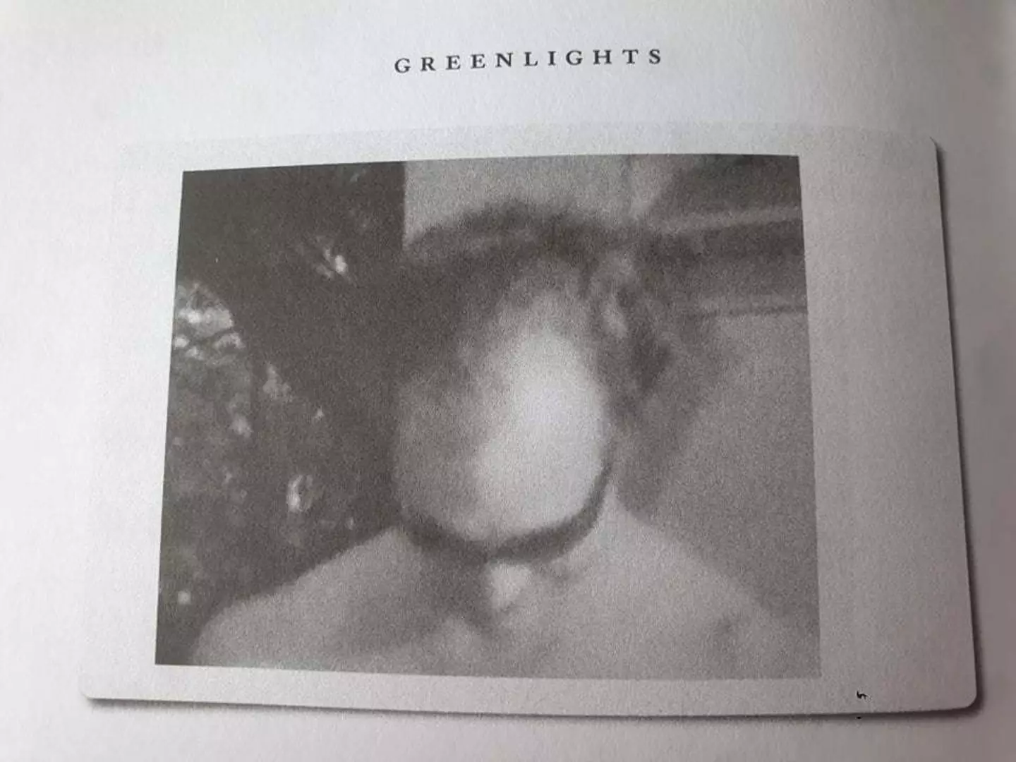 He opens up about his hair loss in his memoir, Greenlights.