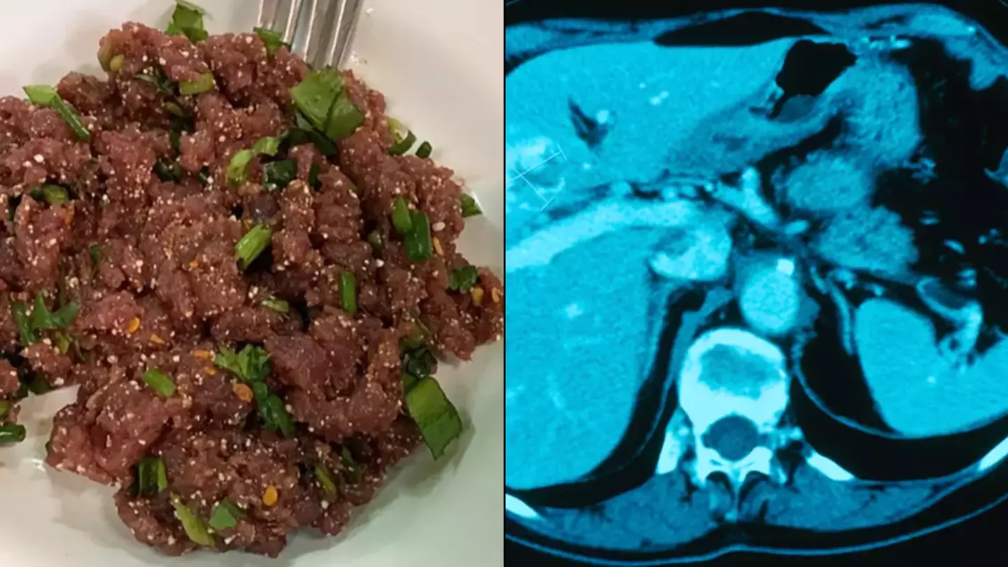 Brits warned taking a single bite of popular Thai dish can give you liver cancer