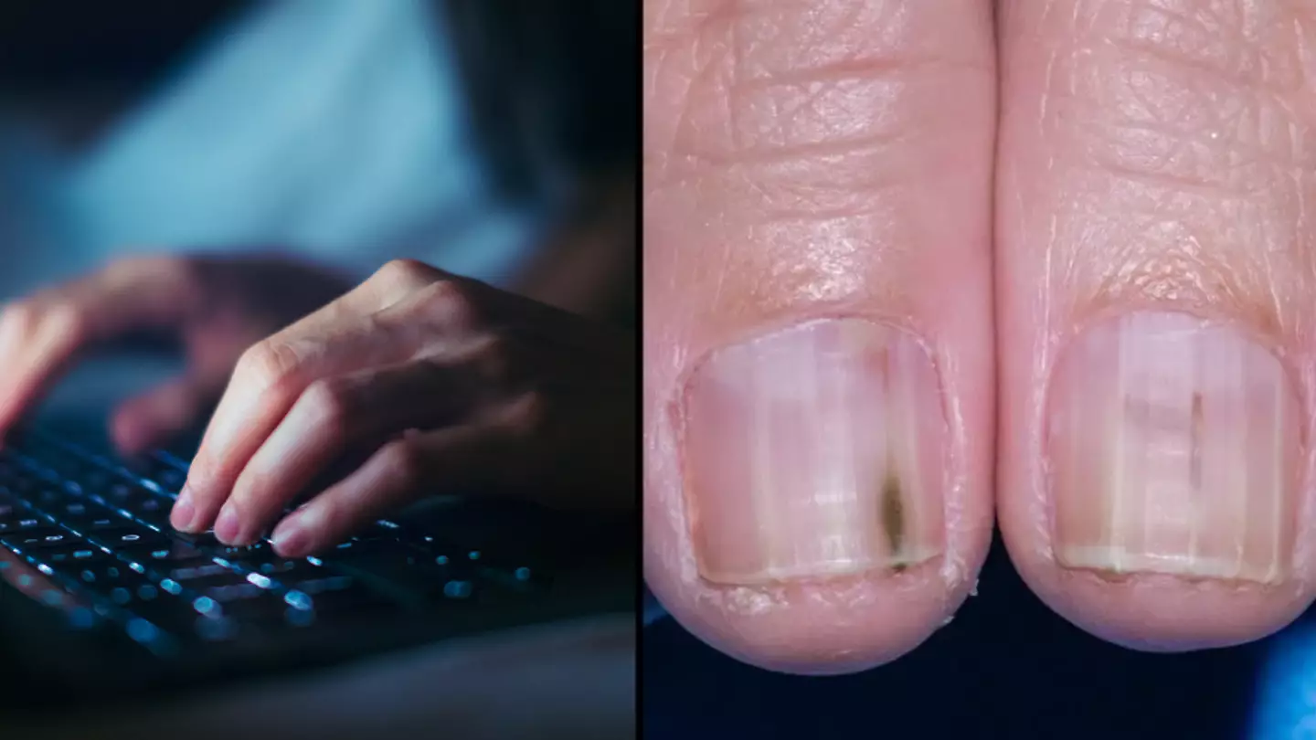 Subtle signs on your fingers that could be sign you’re at risk of cancer