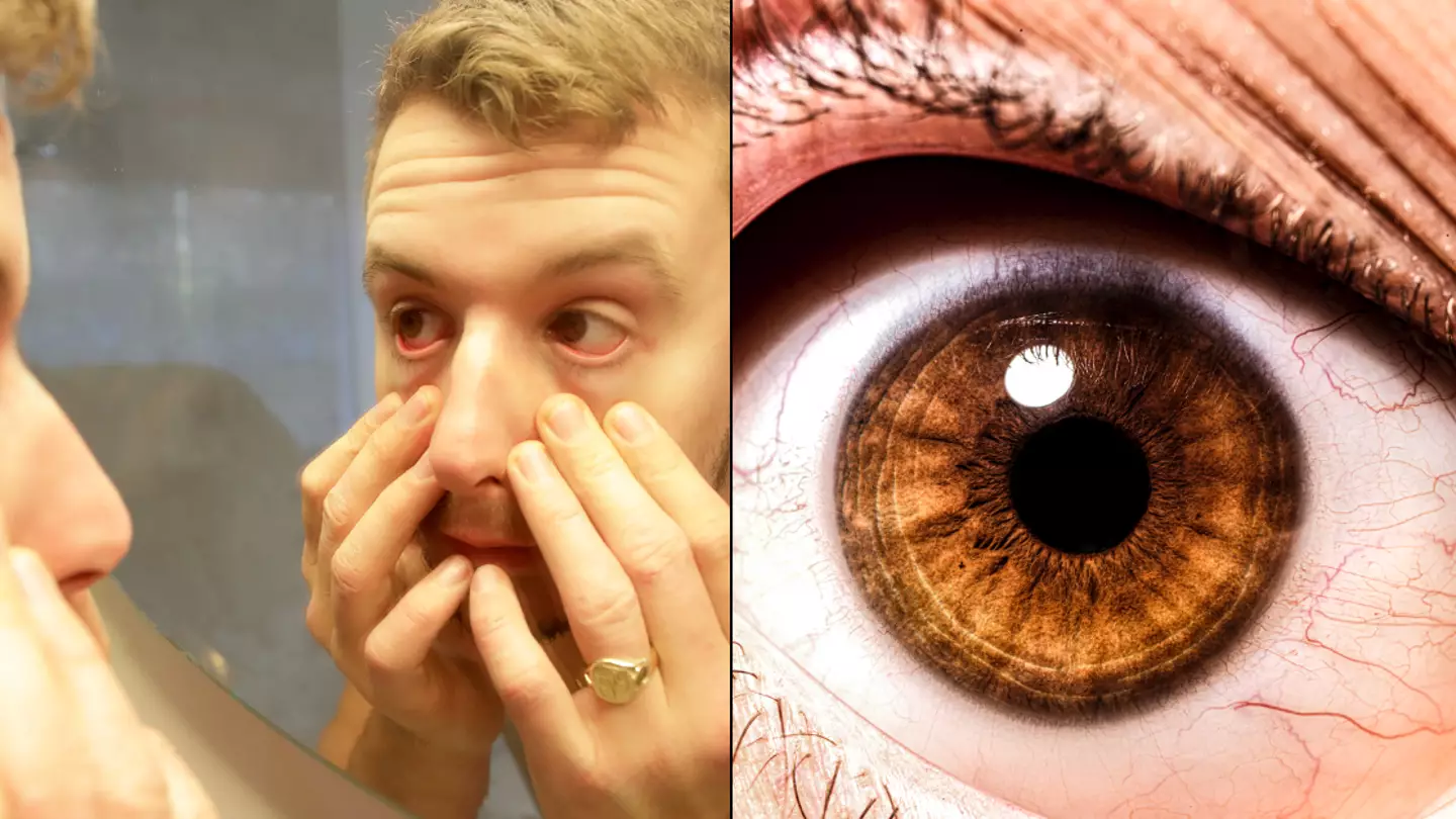 NHS explained why you can sometimes get a 'twitch' in your eye and how you can stop it happening