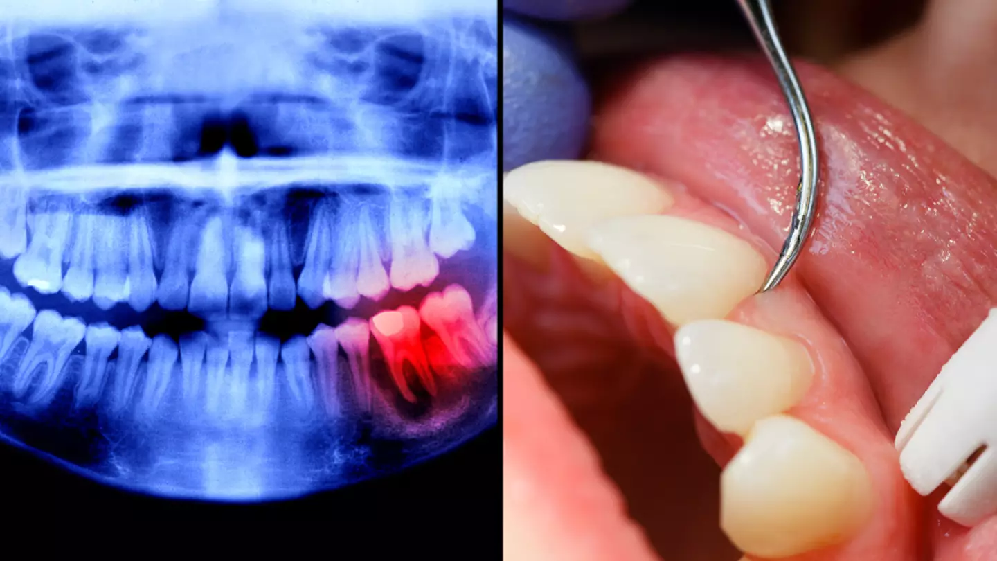Warning signs you have ‘irreversible’ disease in your mouth