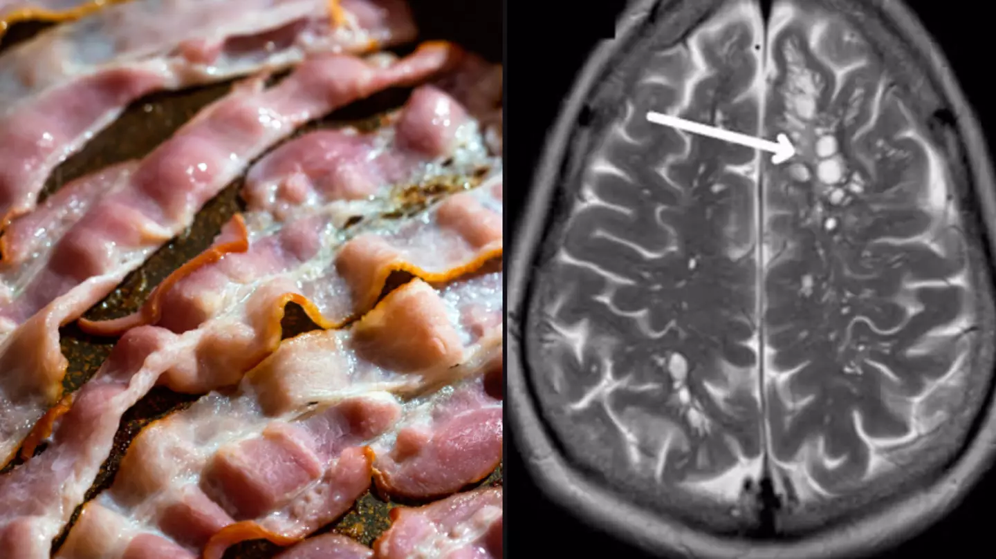 Incredibly dangerous reason you should never eat undercooked bacon