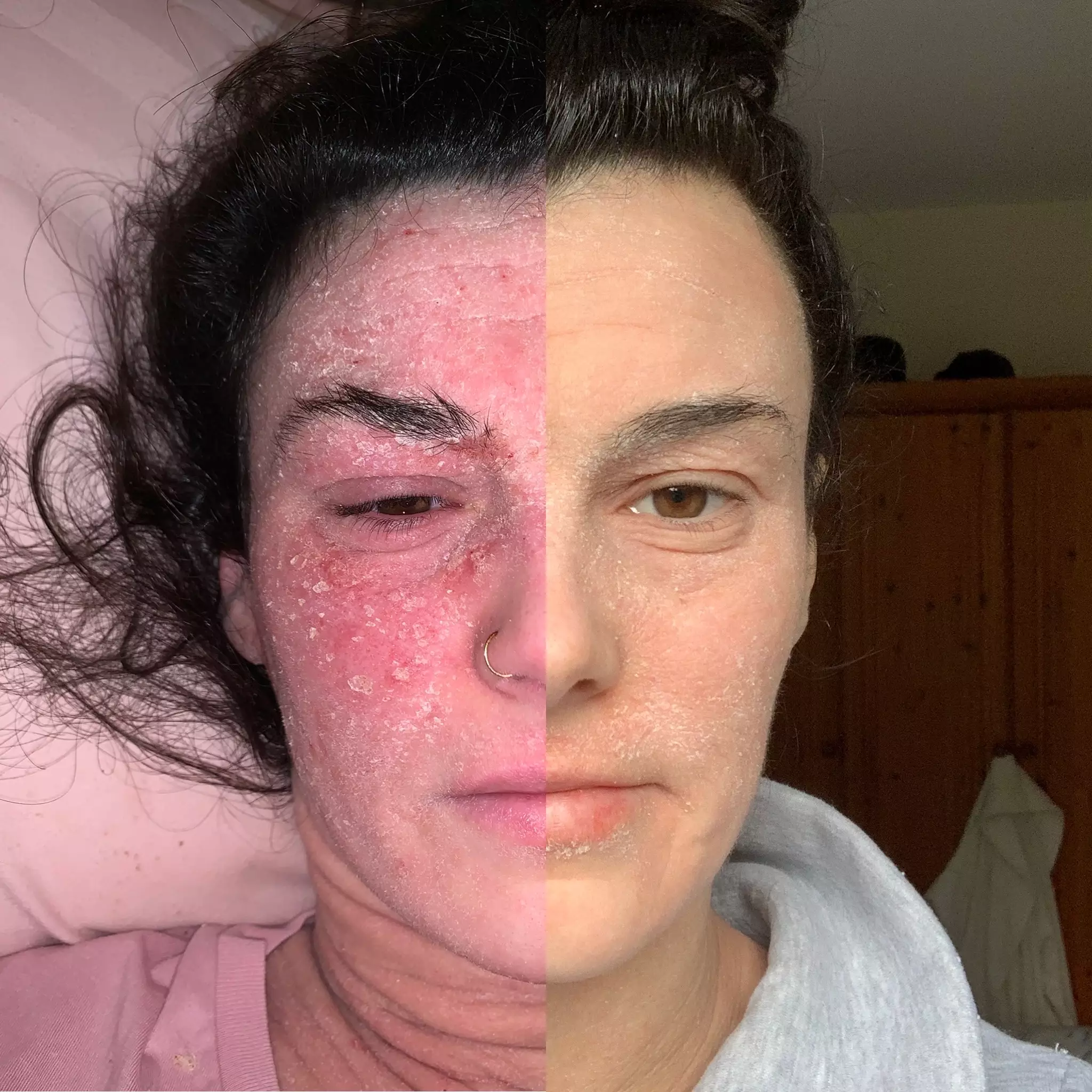Stephanie is seeing some real results with her skin (