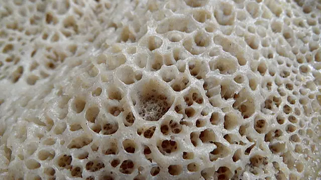 Does this image freak you out? You may suffer from trypophobia