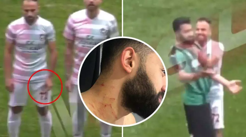 The Shocking Moment Amed SK Footballer Attacked Sakaryaspor Player Before The Match