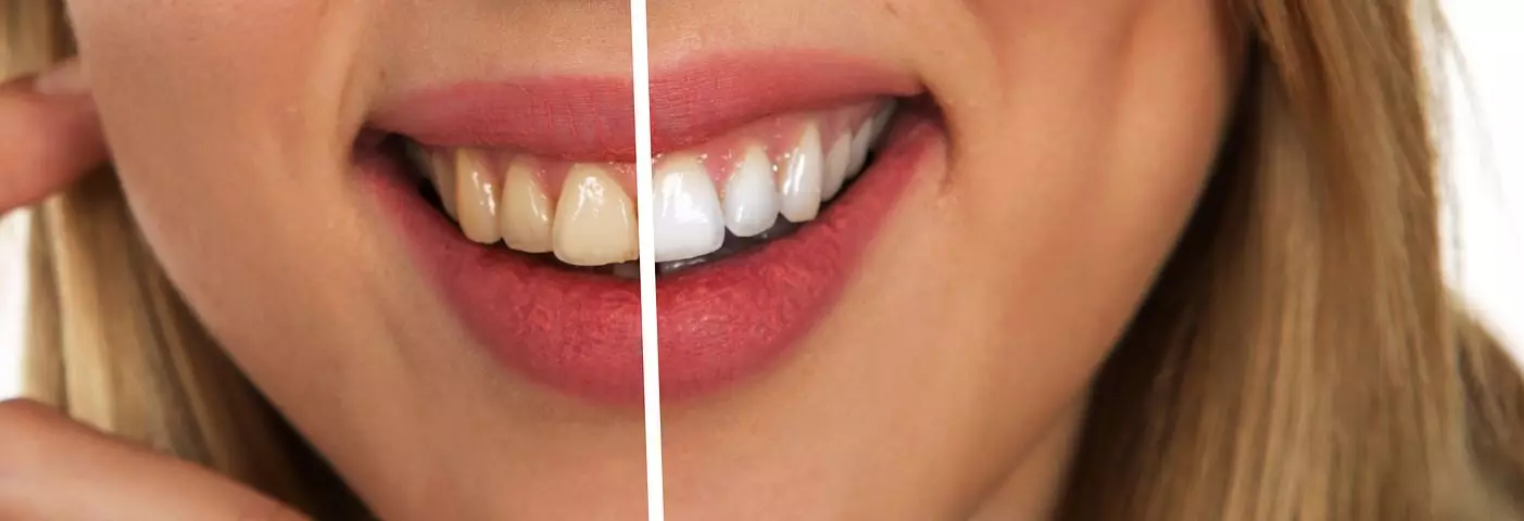 Many of the toothpastes claim to whiten your smile.