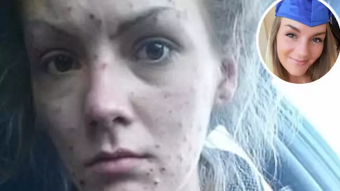 Recovering Meth Addict Shares Incredible Before And After Photos
