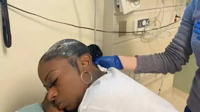 Plastic Surgeon Offers To Remove Gorilla Glue From Woman's Hair For Free