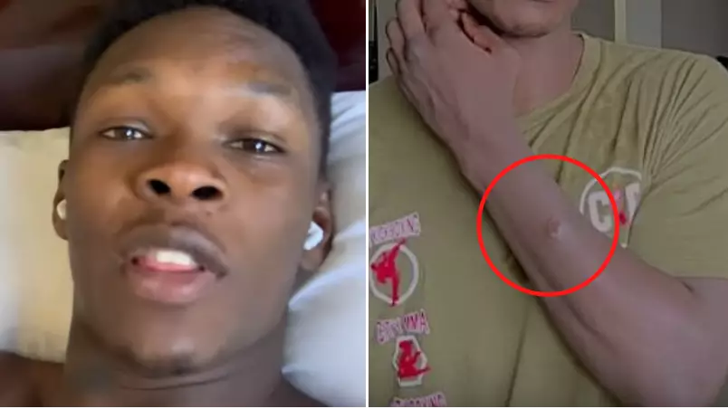 Israel Adesanya Responds To Reports He Has A Staph Infection Ahead Of UFC 248
