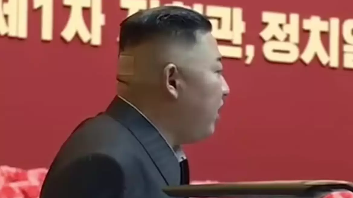 Kim Jong-Un Spotted With Plaster And Dark Mark On His Head