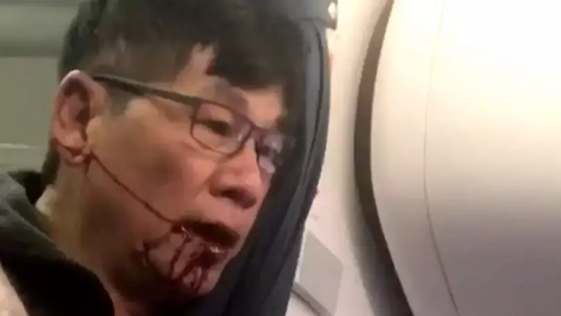 Dr David Dao And United Airlines Have Reached An 'Amicable Settlement'