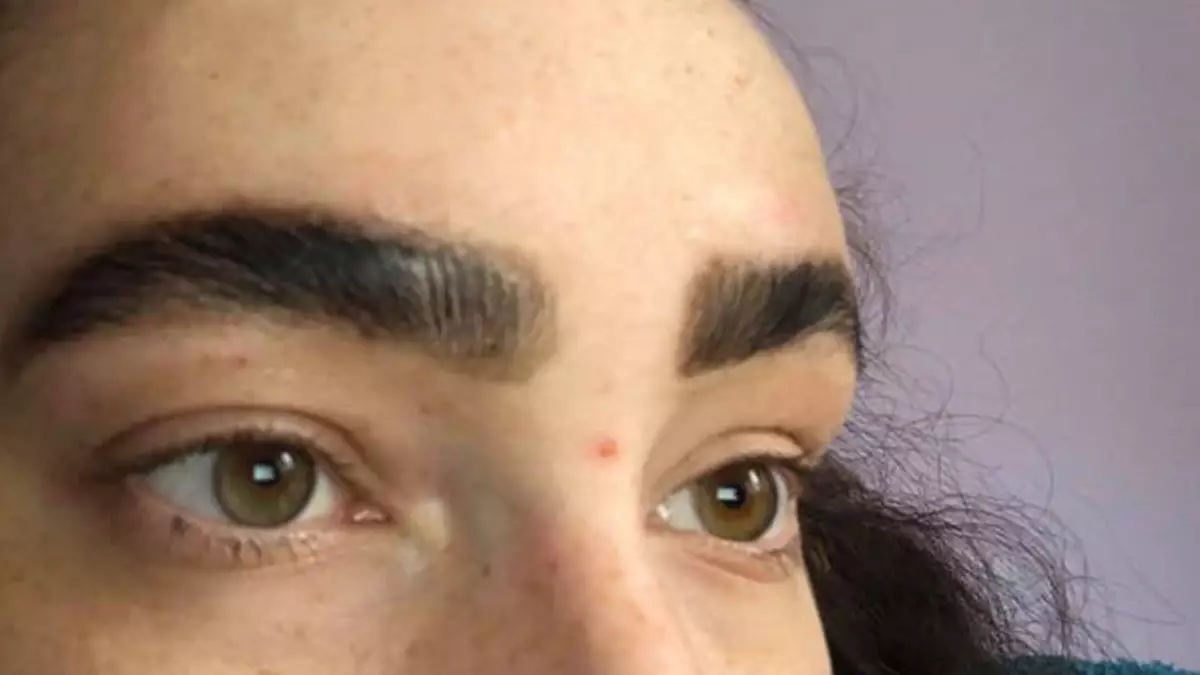 Woman's Eyebrow Lamination Goes Horribly Wrong