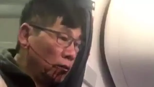 Doctor Hauled Off United Airlines Flight Has Been Named 