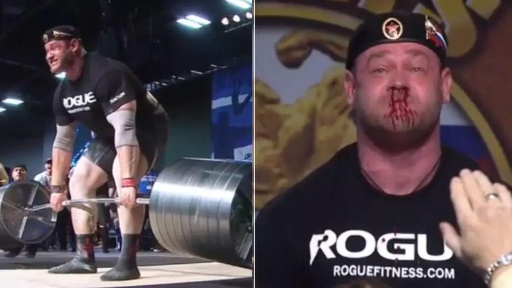 The Moment Weightlifter Bleeds From Nose During 67 Stone Deadlift 