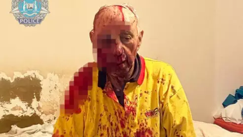 Elderly Australian Man Nearly Beaten To Death Has Woken From His Coma