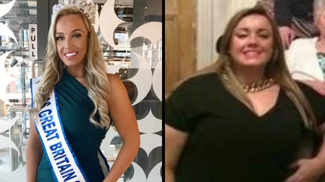 Miss GB Who Lost Eight Stone Claims It's Not Fat-Shaming To Call Someone 'Obese'