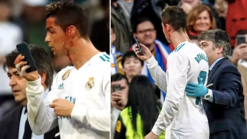 Cristiano Ronaldo Asks Physio For His Mobile Phone To Look At Injury - The Internet Reacts