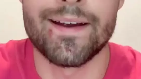 Man Shares Dangers Of Using Someone Else's Razor To Shave 