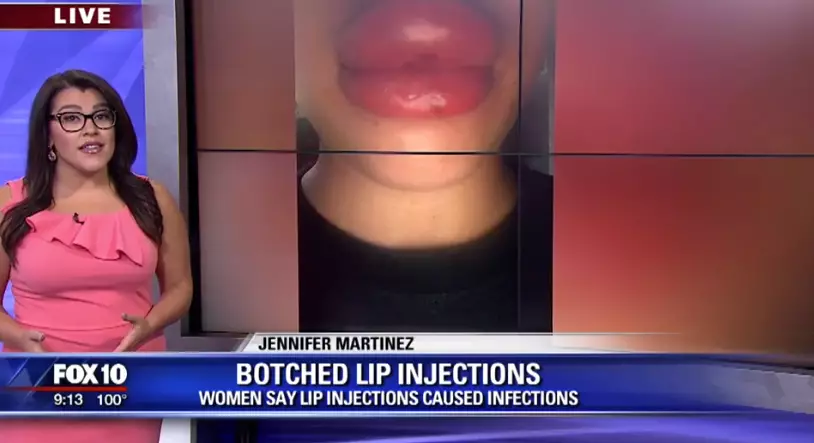 The women say the injections left them swollen and sore.