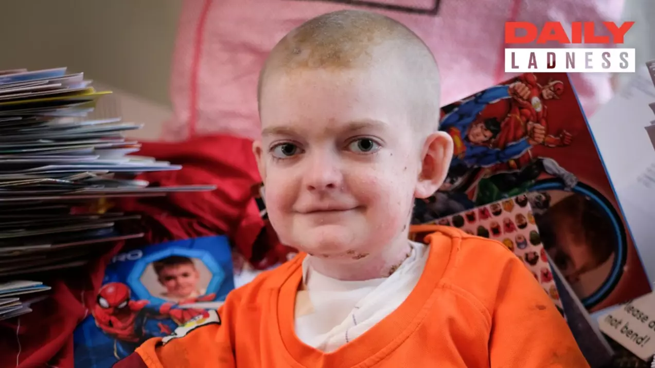 Schoolboy With Agonising Skin Condition Receives More Than 10,000 Birthday Cards 
