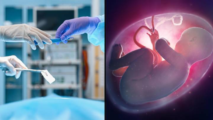 外科医生将试图将子宫移植到跨性别的女人中，以帮助他们怀孕