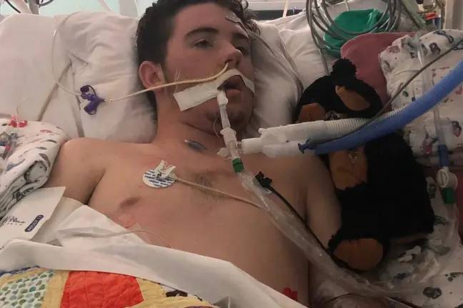由于肺部衰竭，得克萨斯州的一名17岁的Vaper住院数周。学分：ABC