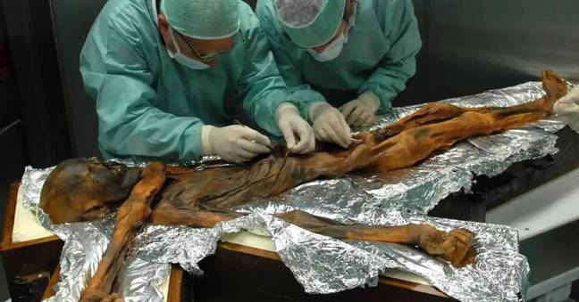 Ötzi保存得很好，科学家可以看到他的肠道中的内容。学分：M.Samadelli/Urac.Southtyrolarchaeogymuseum