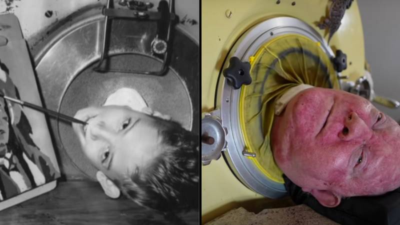 小时候玩耍后，有铁肺的男人在机器上生活了70多年