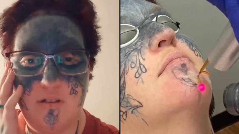Woman who’s face was tattooed against her will has ‘life changed’ after stranger offers to help with removal