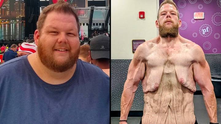 人损失超过150公斤后，炫耀了他令人难以置信的转变