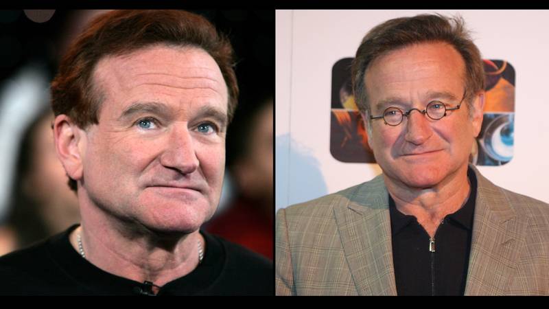 罗宾·威廉姆斯（Robin Williams）的诊断错误仅在他的尸检中才发现
