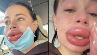 女人发出警告，警告她的嘴唇痛苦痛苦后完成“免费化妆品”