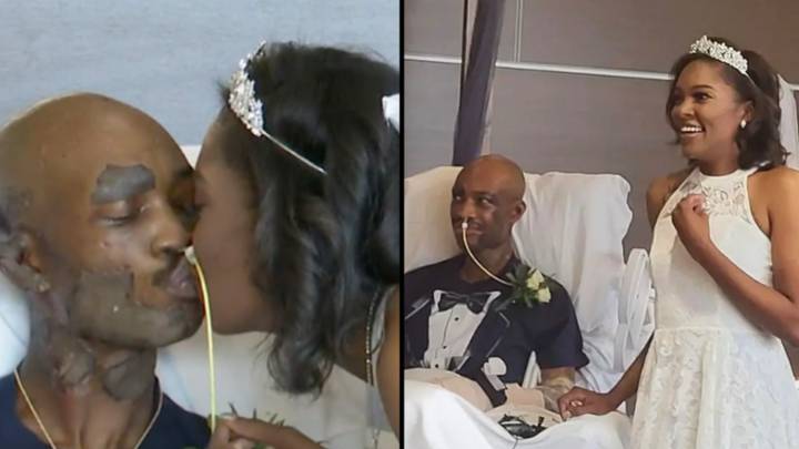 Couple Get Married In Hospital Burns Unit After Groom Suffered Horrific Accident Just Before 