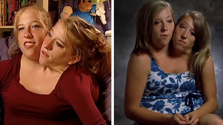 Conjoined twins Abby and Brittany Hensel dream of getting married and ...