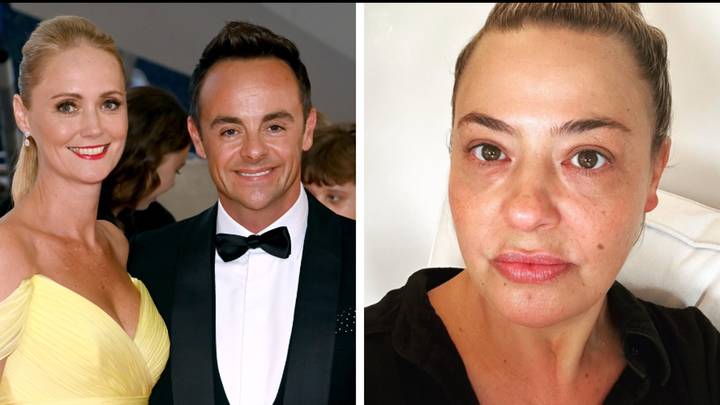 Ant Mcpartlins Newly Single Ex Wife Lisa Armstrong Shares Cryptic Post About Karma