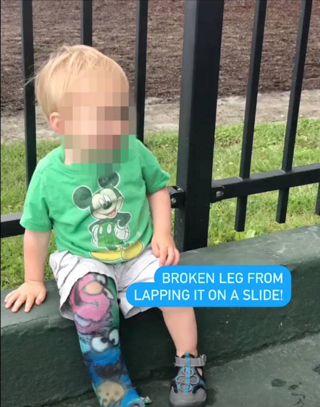 Mum warns of playground mistake after toddler breaks his leg