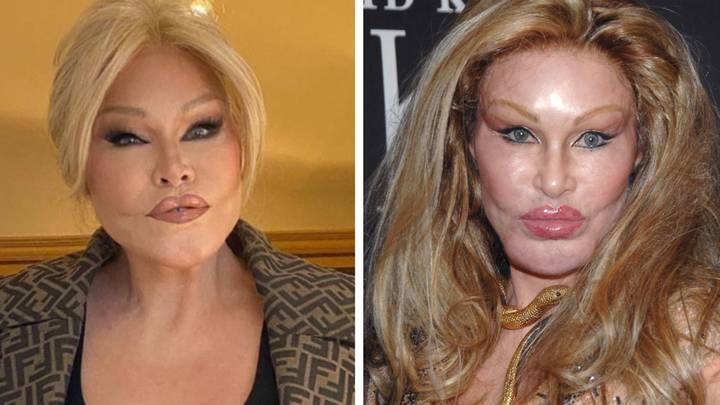 ‘Catwoman’ Jocelyn Wildenstein, 82, stuns fans as she shares age ...