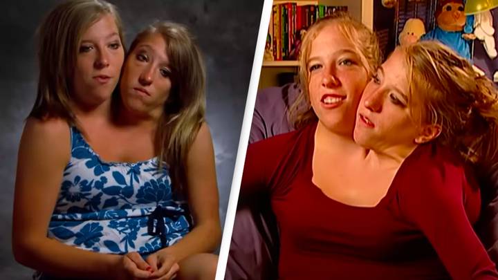 BBC Three - Abby and Brittany: Joined for Life