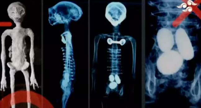 «Рентгеновские снимки» двух предполагаемых «тел инопланетян» были представлены Конгрессу Мексики. Фото: Канал Конгресса Мексики.