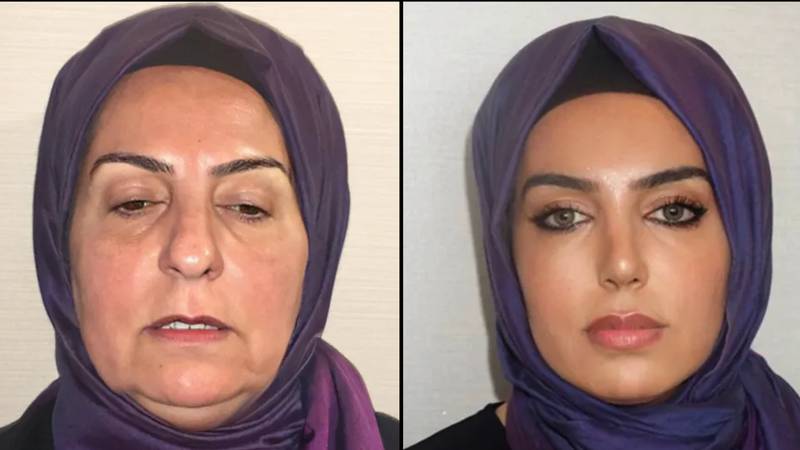 土耳其整形外科诊所的照片之前和之后，人们难以置信