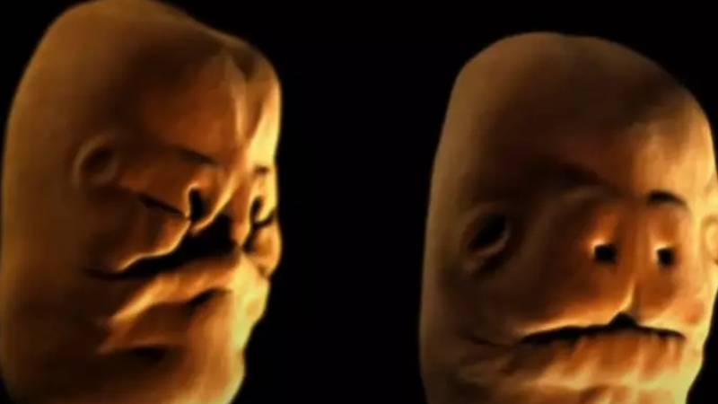 模拟显示婴儿的脸如何发展为噩梦
