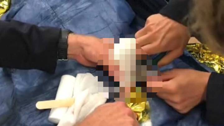 Man Gets Penis Stuck In A Bottle Neck For Two Months