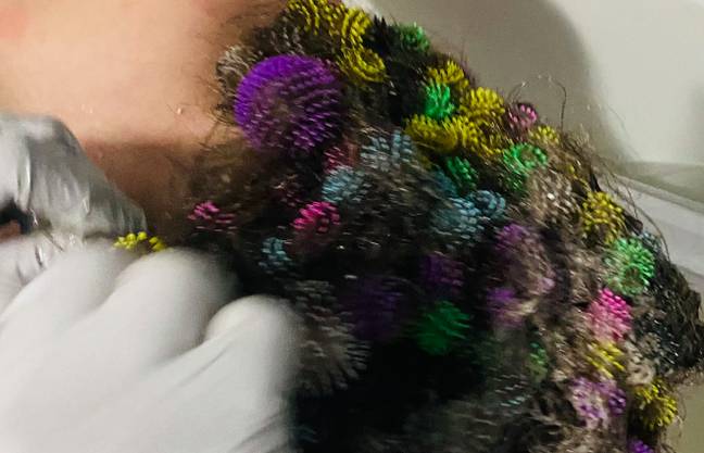 This mom spent 20 hours removing 150 'Bunchems' toys from her daughter's  hair
