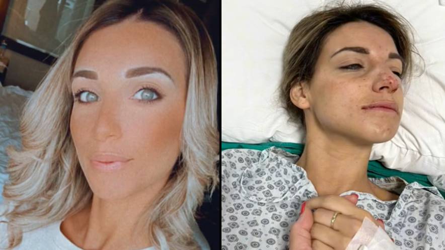 Woman Shares Horror ‘Turkey Teeth’ Experience Which Required Serious Treatment When She Returned To UK Woman Shares Horror ‘Turkey Teeth’ Experience Which Required Serious Treatment When She Returned To UK