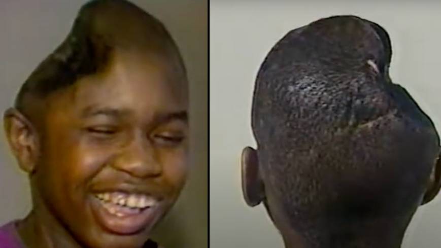 Man who amazed doctors after he cheated death when he lost half his ...