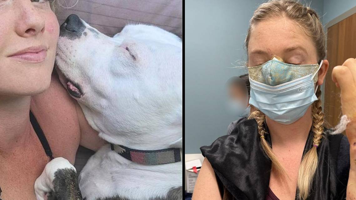 Woman has nose bitten off by boyfriend's dog after it was 'startled by her teeth whitening'
