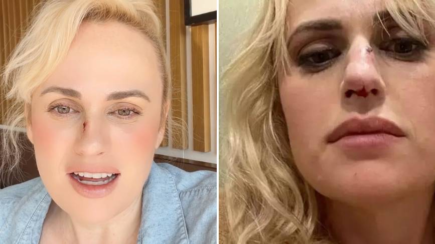 Pitch Perfect's Rebel Wilson shares update after she was taken to ...