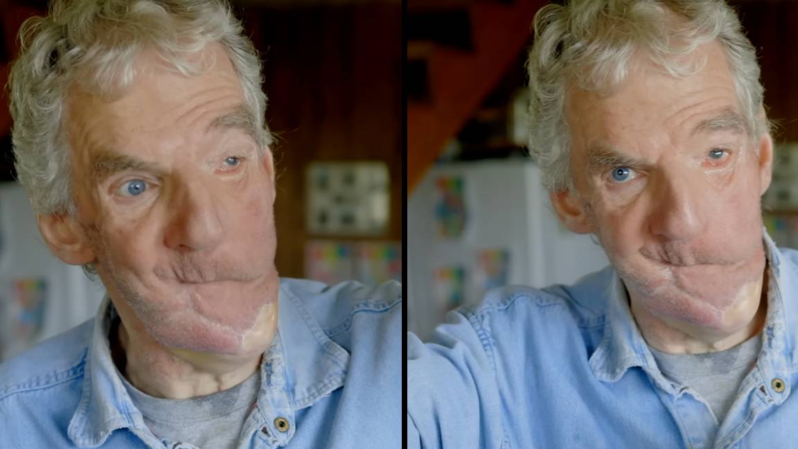 Man who had face ripped off by bear dug mud out of his own airways to ...